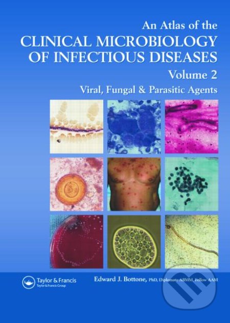 An Atlas of the Clinical Microbiology of Infectious Diseases (Volume 2) - Edward J. Bottone, CRC Press, 2006