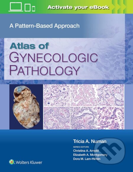 Atlas of Gynecologic Pathology - Tricia A. Numan, Wolters Kluwer Health, 2023