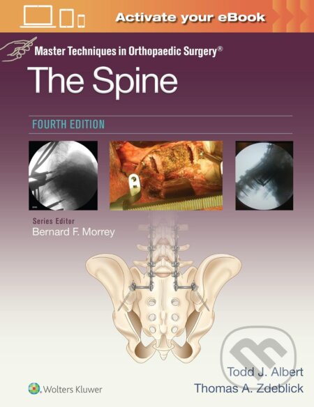 Master Techniques in Orthopaedic Surgery: The Spine - Thomas A. Zdeblick, Todd Albert, Wolters Kluwer Health, 2023