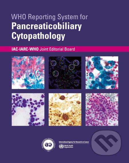 WHO reporting system for Pancreaticobiliary Cytopathology - kniha z kategorie Medicína