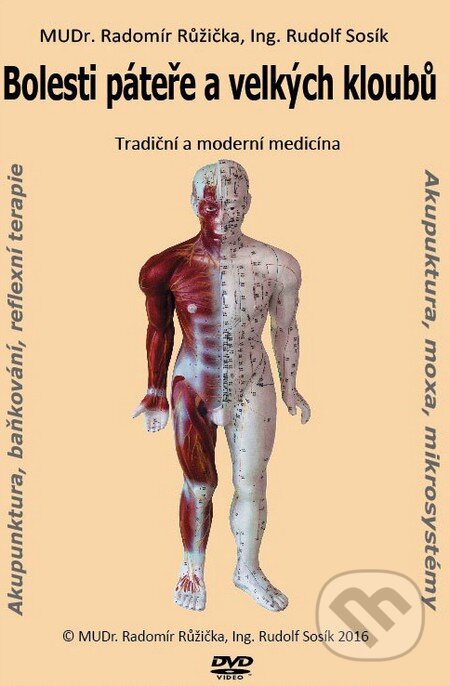 Bolesti páteře a velkých kloubů 1 - Radomír Růžička, Rudolf Sosík, CAD PRESS, 2015