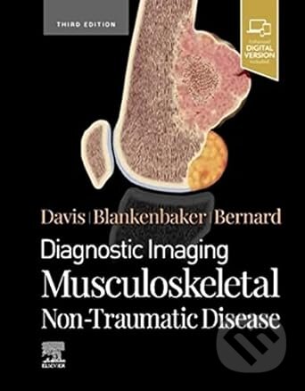 Diagnostic Imaging: Musculoskeletal Non-Traumatic Disease - Kirkland W. Davis, Donna G Blankenbaker, Stephanie Bernard, Elsevier Science, 2022
