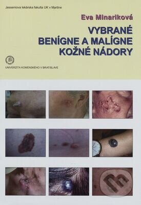Vybrané benígne a malígne kožné nádory - Eva Mináriková, Univerzita Komenského Bratislava, 2017