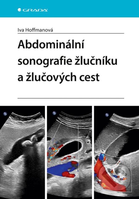 Abdominální sonografie žlučníku a žlučových cest - Iva Hoffmanová, Grada, 2024