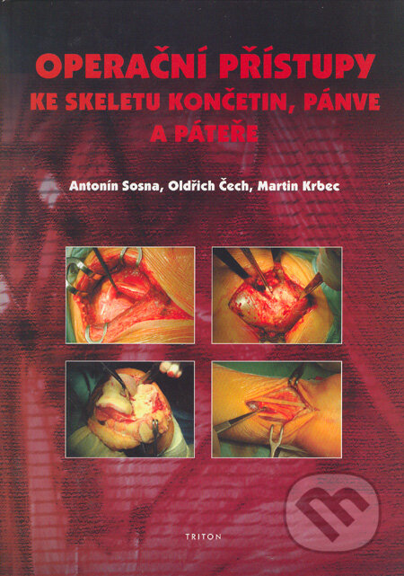 Operační přístupy ke skeletu končetin, pánve a páteře - Antonín Sosna, Oldřich Čech, Martin Krbec, Triton, 2005