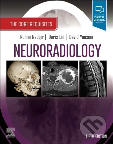 Neuroradiology - Rohini Nadgir, Doris Lin, David M. Yousem, Elsevier Science, 2024