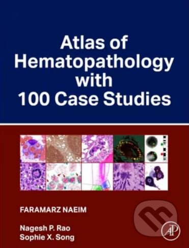 Atlas of Hematopathology with 100 Case Studies - Faramarz Naeim, P. Nagesh Rao, Sophie X. Song, Elsevier Science, 2024