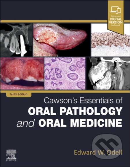 Cawson&#039;s Essentials of Oral Pathology and Oral Medicine - Edward W Odell, Elsevier Science, 2024