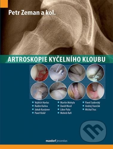 Artroskopie kyčelního kloubu - Petr Zeman a kolektiv, Maxdorf, 2016