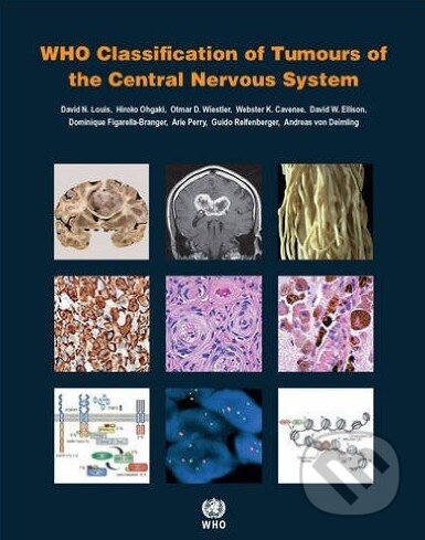 WHO Classification of Tumours of the Central Nervous System - Kolektív autorov, World Health Organization, 2016