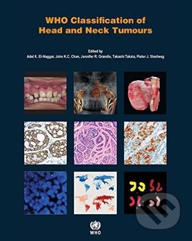 WHO Classification of Head and Neck Tumours - Adel K. El-Naggar a kol. - kniha z kategorie Medicína
