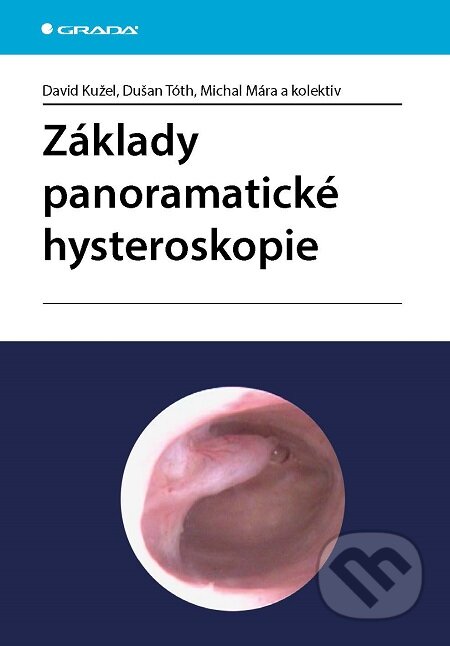 Základy panoramatické hysteroskopie - David Kužel, Dušan Tóth, Michal Mára a kolektiv, Grada, 2016