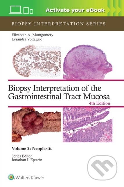 Kniha: Biopsy Interpretation of the Gastrointestinal Tract Mucosa Volume 2 : Neoplastic (ELIZABETH ANNE MONTGOMERY a Lysandra Voltaggio)