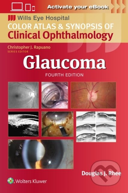 Kniha: Glaucoma: Wills Eye Institute Atlas Series (Douglas J. Rhee)