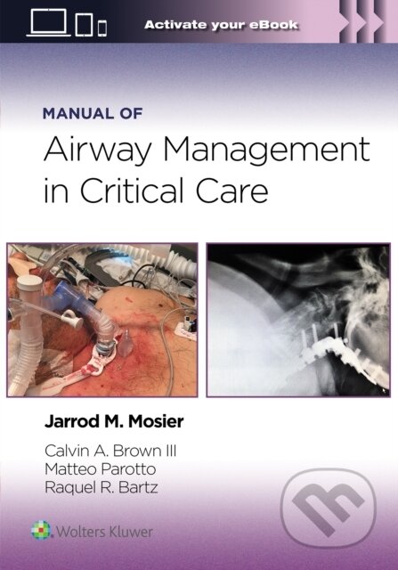 Kniha: Manual of Airway Management in Critical Care (Jarrod Mosier, Calvin A Brown III, Matteo Parotto a Raquel Rae Bartz)