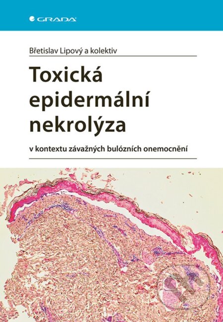 Kniha: Toxická epidermální nekrolýza (Břetislav Lipový)