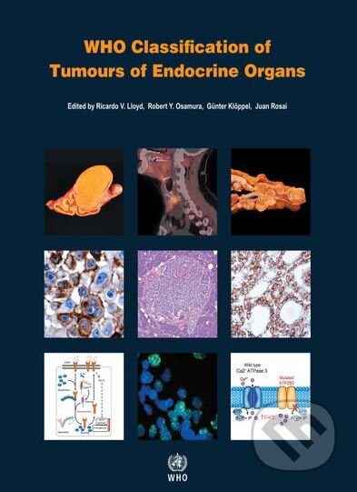 WHO Classification of Tumours of Endocrine Organs (Fourth Edition) - kniha z kategorie Medicína