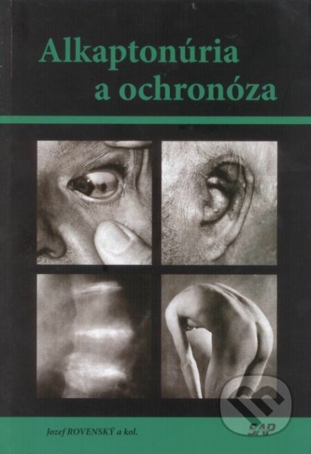 Alkaptonúria a ochronóza - Jozef Rovenský, Slovak Academic Press, 2011