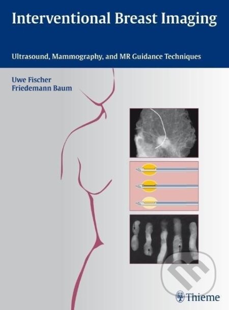Kniha: Interventional Breast Imaging (Uwe Fischer). Georg Thieme Verlag, 2010