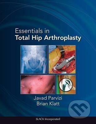 Kniha: Essentials in Total Hip Arthroplasty (Javad Parvizi). CRC Press, 2013