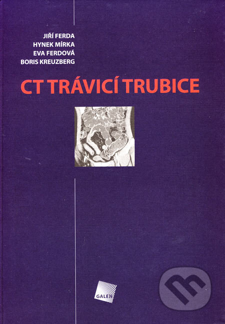 CT trávicí trubice - Jiří Ferda a kol., Galén, 2006