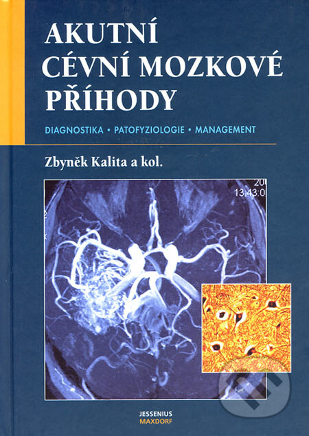 Akutní cévní mozkové příhody - Zbyněk Kalita a kol., Maxdorf, 2007