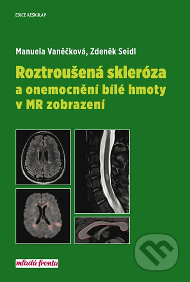Roztroušená skleróza a onemocnění bílé hmoty v MR zobrazení - Manuela Vaněčková,  Zdeněk Seidl, Mladá fronta, 2018
