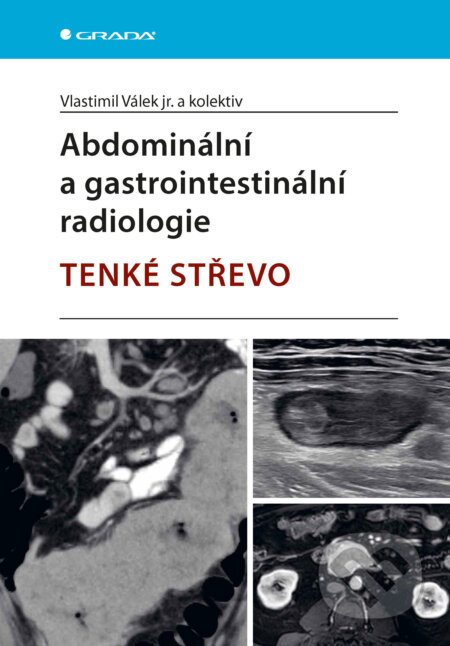 E-kniha: Abdominální a gastrointestinální radiologie (Válek jr. Vlastimil a kolektív). Grada, 2025