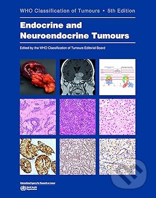 WHO Classification of Endocrine and Neuroendocrine Tumours