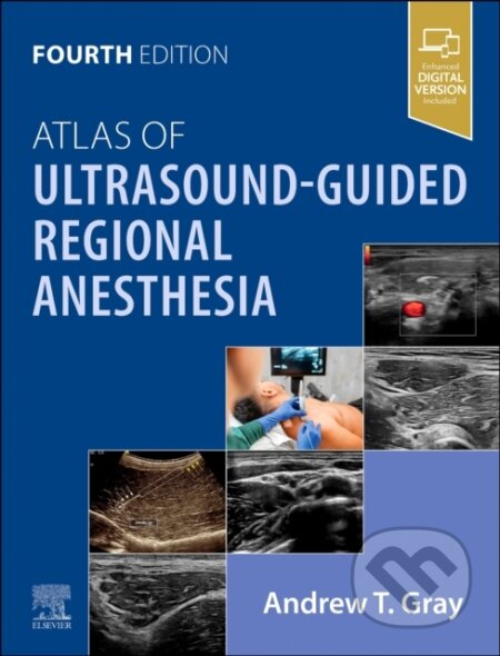 Kniha Atlas of Ultrasound-Guided Regional Anesthesia