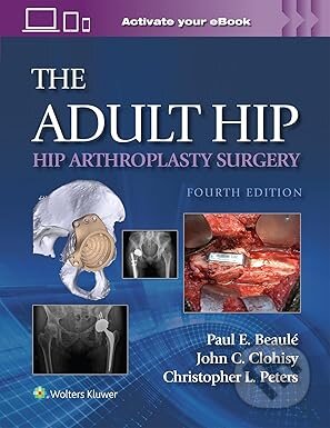 Adult Hip Hip Arthroplasty Surgery Print (Fourth Edition)
