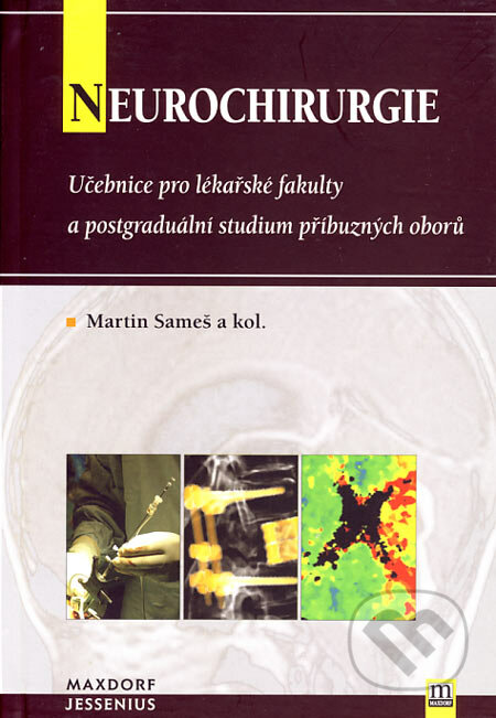 Neurochirurgie - Martin Sameš a kol., Maxdorf, 2005