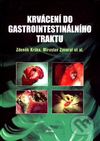 Krvácení do gastrointestinálního traktu - Zdeněk Krška, Miroslav Zavoral, Triton, 2007