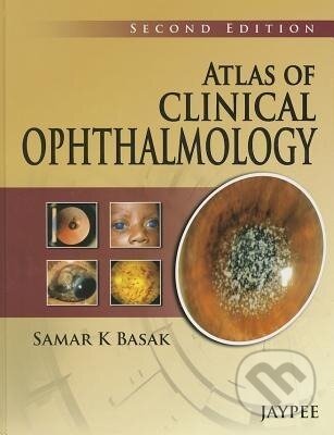 Kniha: Atlas of Clinical Ophthalmology (Samar K Basak). , 2013