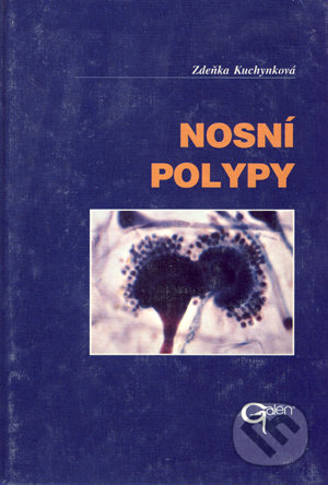 Nosní polypy - Zdeňka Kuchynková, Galén, 2003