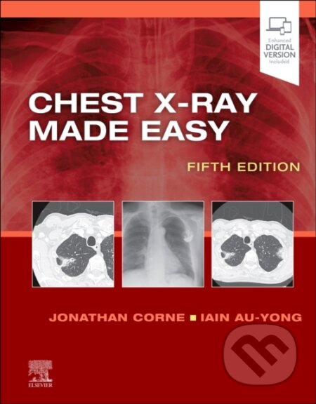 Kniha: Chest X-Ray Made Easy (Iain, MA, BMBCh, MRCS, FRCR Au-Yong, Jonathan, PhD, MB BS a FRCP Corne). Elsevier Science, 2022