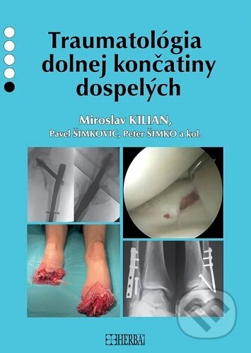Kniha: Traumatológia dolnej končatiny dospelých (Miroslav Kilian). , 2026