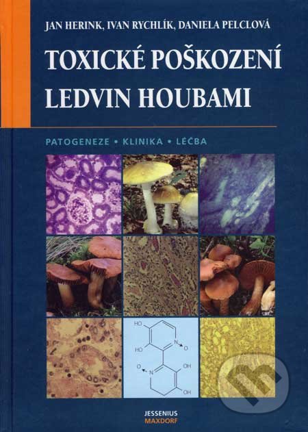 Toxické poškození ledvin houbami - Jan Herink, Ivan Rychlík, Daniela Pelclová, Maxdorf, 2007