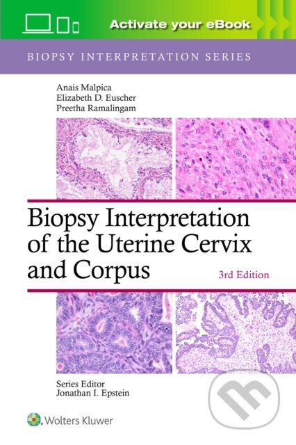 Kniha: Biopsy Interpretation of the Uterine Cervix and Corpus: Print + eBook with Multimedia (ANAIS MALPICA, Preetha, MD Ramalingam, Elizabeth D. Euscher a Preetha Raj Kannan). Wolters Kluwer Health, 2026