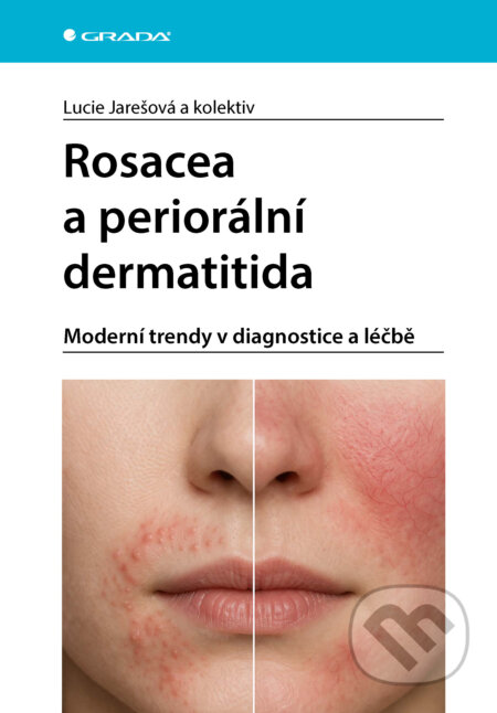 E-kniha: Rosacea a periorální dermatitida (Lucie Jarešová a kolektív). Grada, 2026