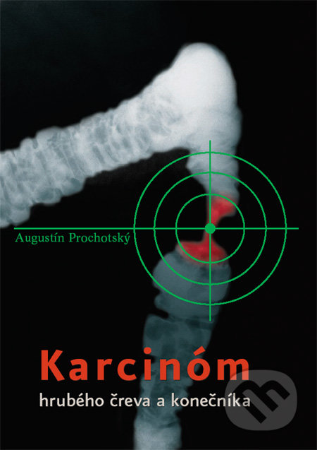 Karcinóm hrubého čreva a konečníka - Augustín Prochotský, Litera Medica, 2006