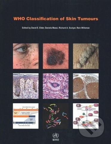 Who Classification of Skin Tumours - D.E. Elder - kniha z kategorie Medicína