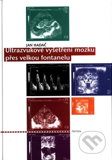 Ultrazvukové vyšetření mozku přes velkou fontanelu - Jan Hadač, Triton, 2000