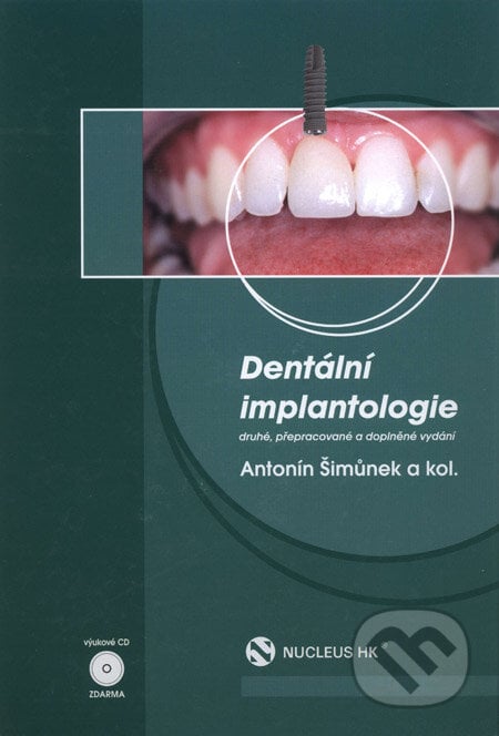 Dentální implantologie - Antotnín Šimůnek a kolektív, Nucleus HK, 2008