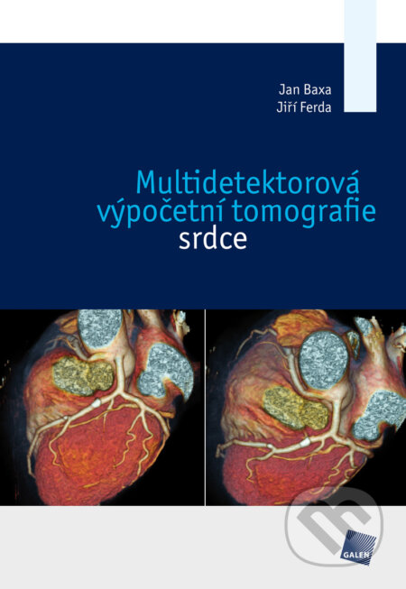 Multidetektorová výpočetní tomografie srdce - Jan Baxa, Jiří Ferda, Galén, 2012