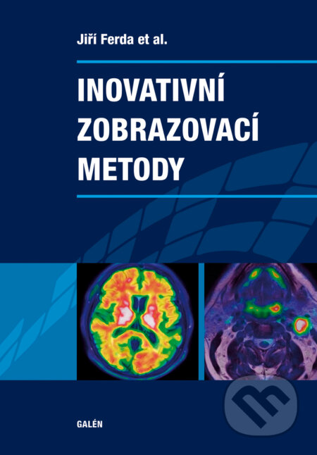 Inovativní zobrazovací metody - Jiří Ferda, Galén, 2015