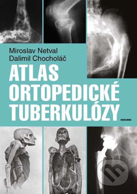 Atlas ortopedické tuberkulózy - Dalimil Chocholáč, Miroslav Netval, Karolinum, 2014