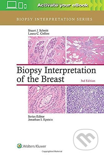 Biopsy Interpretation of the Breast, Lippincott Williams & Wilkins, 2017