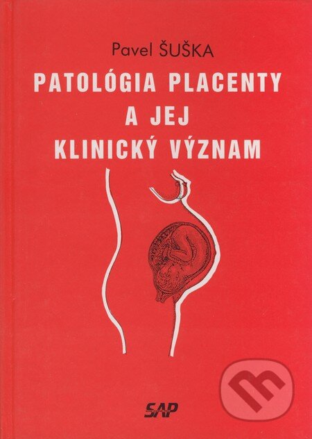 Patológia placenty a jej klinický význam - Pavel Šuška, Slovak Academic Press, 1995