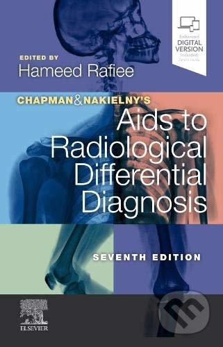 Chapman and Nakielny&#039;s Aids to Radiological Differential Diagnosis - Hameed Rafiee, Elsevier Science, 2019